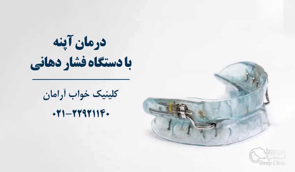 درمان وقفه تنفسی خواب با فشار دهانی
