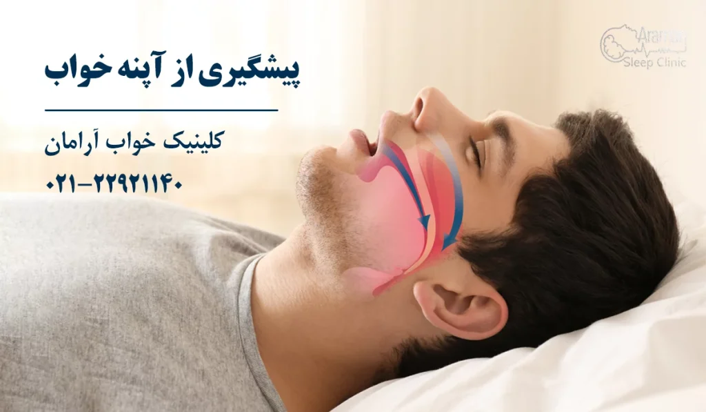 پیشگیری از وقفه تنفسی خواب (آپنه خواب)