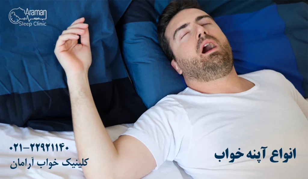 انواع آپنه خواب