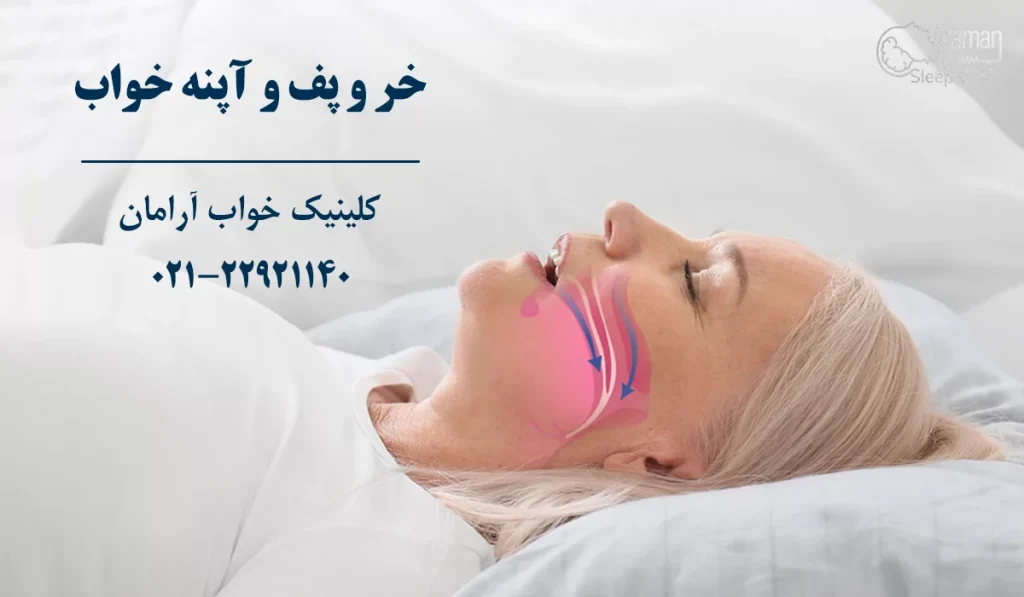 خروپف و آپنه خواب