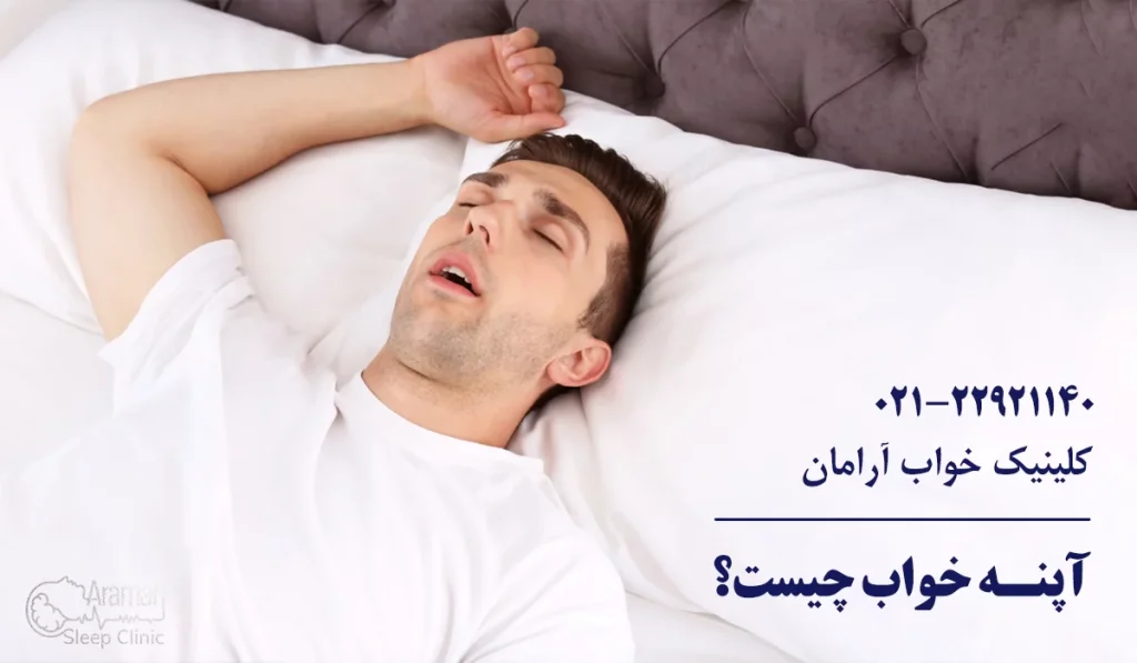 آپنه خواب