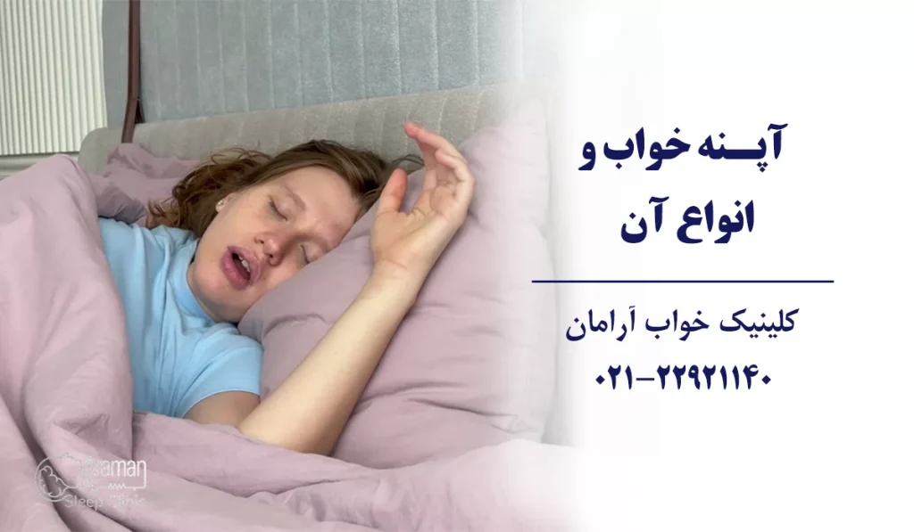 انواع آپنه خواب