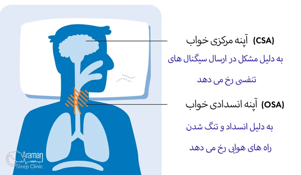 آپنه مرکزی خواب
