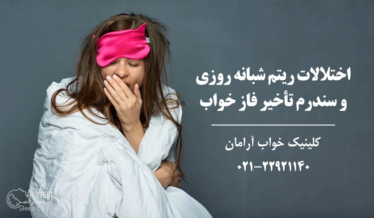 اختلال ریتم شبانه 