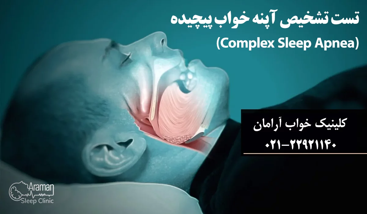 آپنه خواب پیچیده