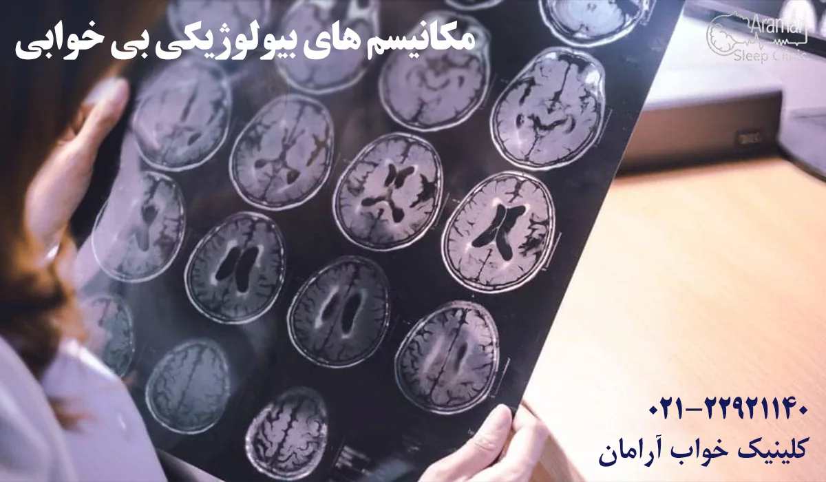 مکانیسم بیولوژی بی خوابی